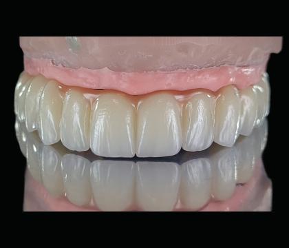 Suprastruktury – "All on X"