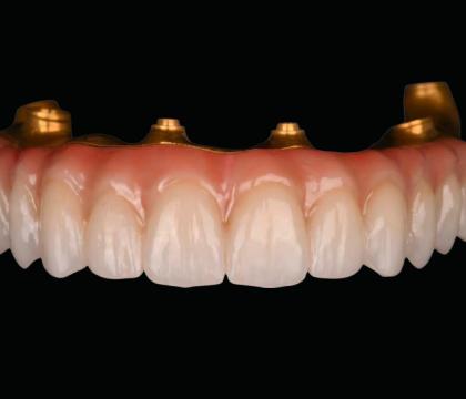 Suprastruktury cyrkonowe