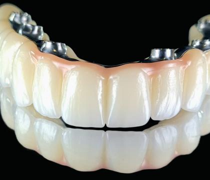 Suprastruktury – "All on X"