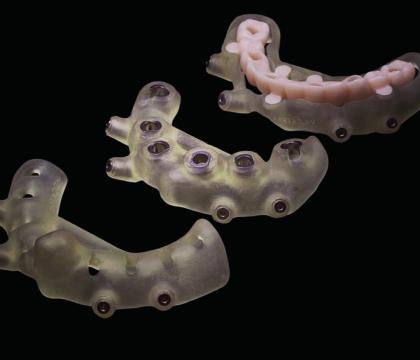 Szablony chirurgiczne/szyny/splinty