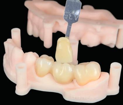 Cyrkon estetyczny i PMMA