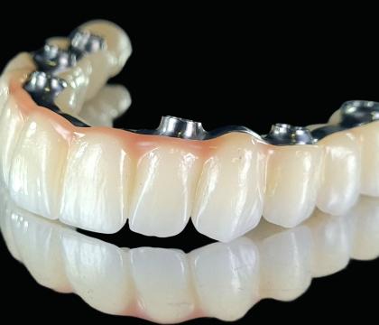 Suprastruktury – "All on X"